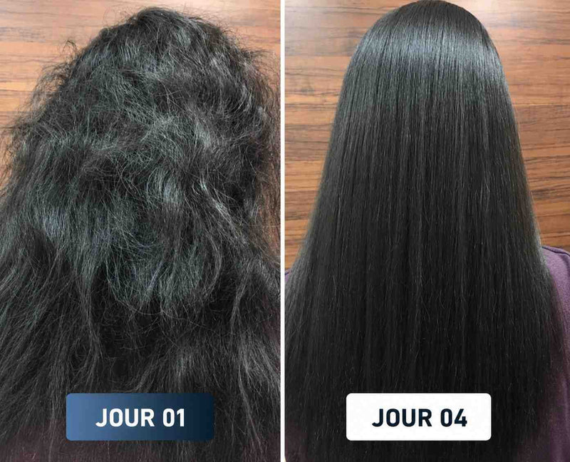 Avant Après