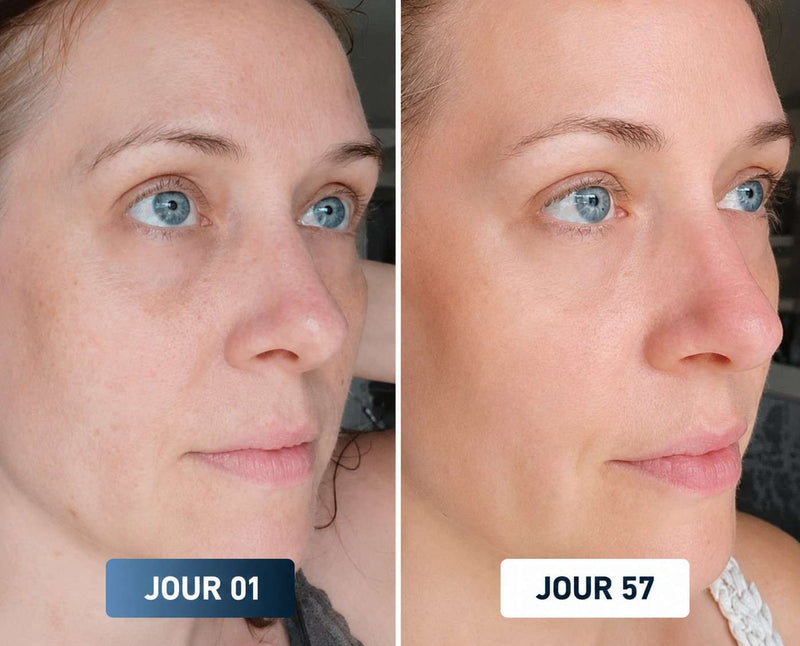 Avant Après