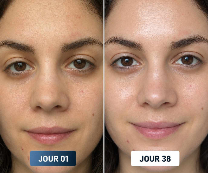 Avant Après